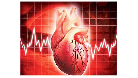 organ-donation