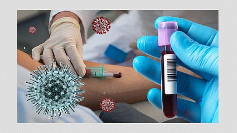 plasma-therapy1.jpg