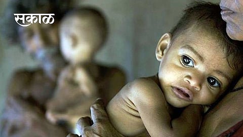 malnutrition