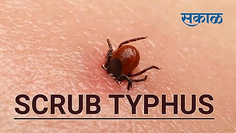 Two patients with scrub typhus were found again in the capital