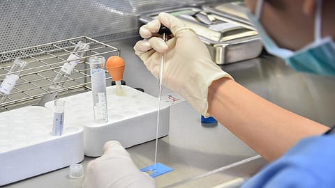 Infertility in male