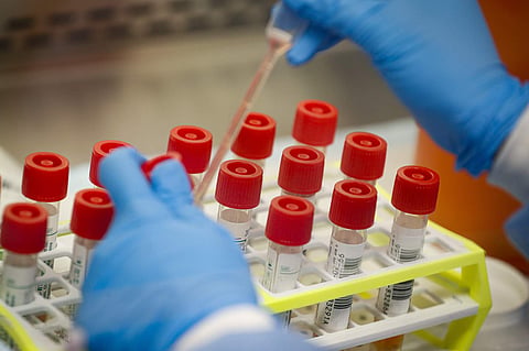आता लवकरच औरंगाबादेत होणार कोरोना स्वॅबची तपासणी