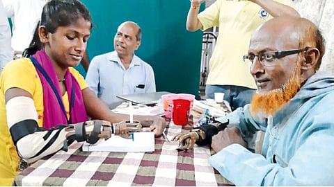 हडपसर - एल. एन.-४ कृत्रिम हात बसविल्यानंतर त्याच्या वापराबाबत दिव्यांग अर्चना यमकर हिला लेखणी चालविण्याचे प्रशिक्षण देताना हसनचाचा शेख.