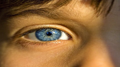 Eye Cataract