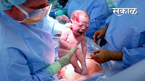 An average of one and a half hundred babies are born daily in Nagpur baby born news