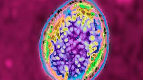 brucellosis