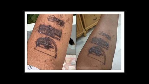 former mp madhu goud yaskhi quarantine stamp at delhi airport hand reaction