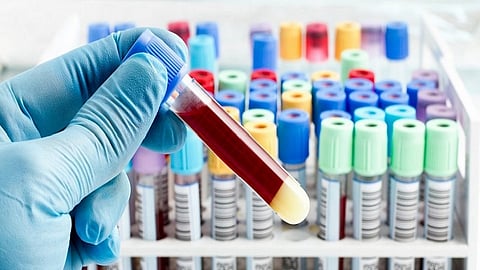 Tumor markers