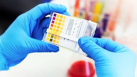 antigen test kits