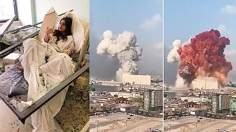 Bloodied Clothes Newborn In His Arms Photo Captures Beirut Blast Horror.jpg
