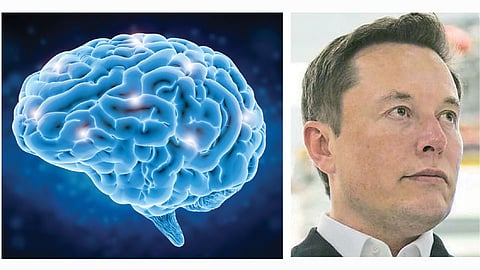 Brain