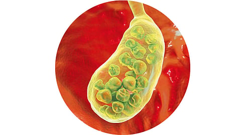 Gall-bladder