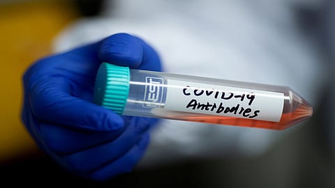 antibodies test.jpg