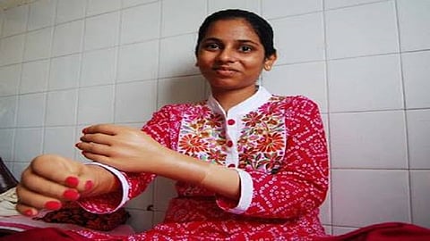 आज मोनिकाचे बाबा हवे होते!; हात प्रत्यारोपणानंतर आई कविता मोरे यांच्या भावना झाल्या अनावर