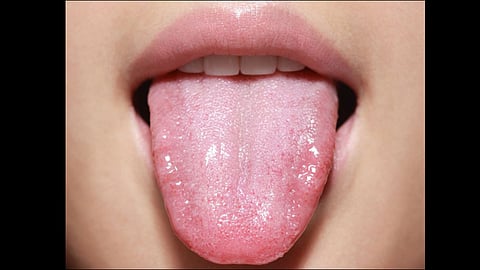 under the superstition women cuts her tongue for return of daughter in law at jharkhand