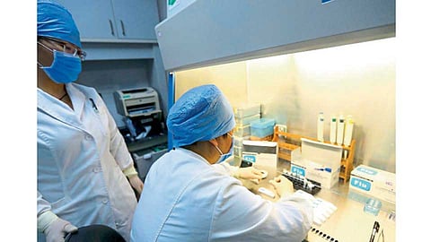 Flu-Test