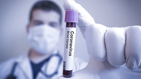 Human testing of possible vaccine of coronavirus begins in Britain