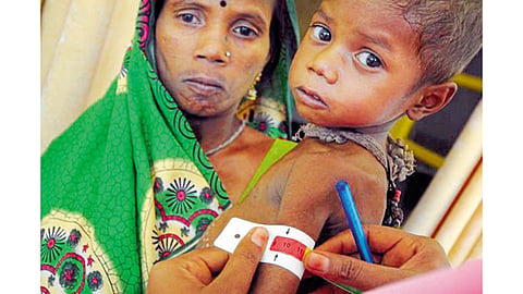नंदुरबार जिल्ह्यात कुपोषणाचा विळखा होतोय सैल