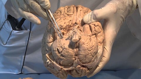 Meninges