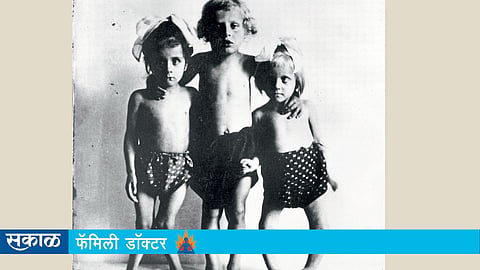 मुले सारखी आजारी पडतात? (डॉ. राहुल नागपाल)