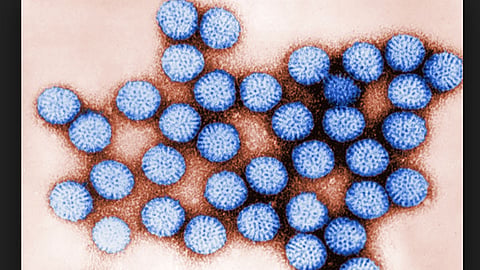 Rotavirus