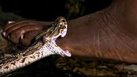 snakebite
