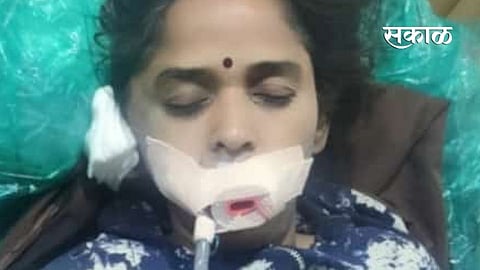 women accident injured