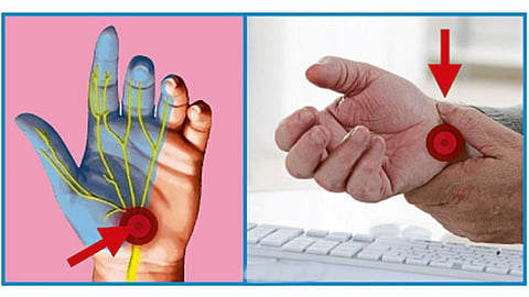 Wrist-Veins