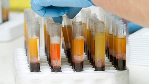 plasma blood tubes