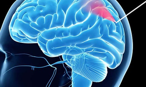 brain