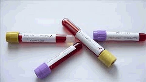 Details of the Corona test will now be available online