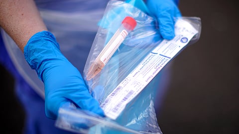 coronavirus test