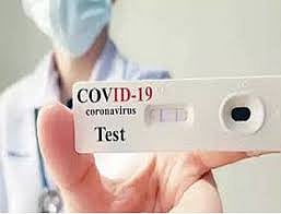 Antigen Tests in Industrial Estates Aurangabad News
