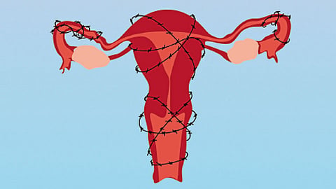 endometriosis