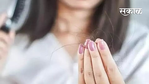 women and men hair fall causes information Health marathi news