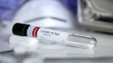 Corona tested after coming in contact with Vaibhav Naik All administer report negative