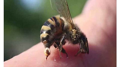 Bee-Attack