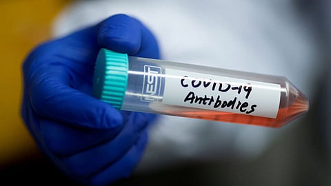 Corona-antibody
