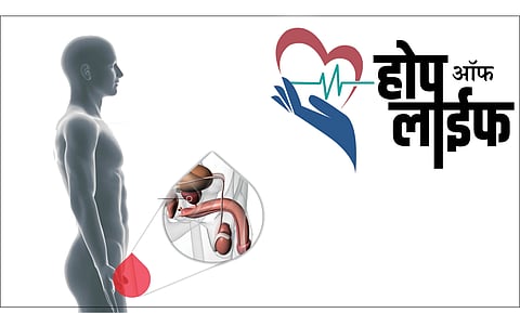 #HopeOfLife : पुरःस्थ ग्रंथीचा कर्करोग!