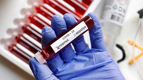 सोलापूरच्या ग्रामीण भागात कोरोनामुळे 15 जणांचा मृत्यू; 472 नवे बाधित