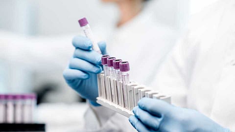 corona_20lab_2.jpg