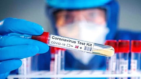 corona-test.jpg