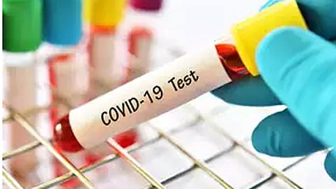 covid-19 test