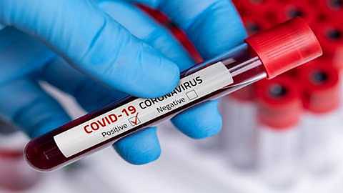 kadus village were worried due to a MLA infected with coronaVirus