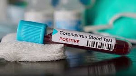 Coronavirus
