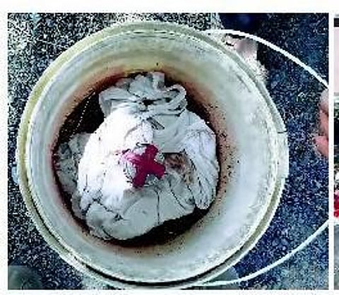 சிதம்பரத்தில் நாட்டுகுண்டு வெடித்து ஒருவர் படுகாயம்