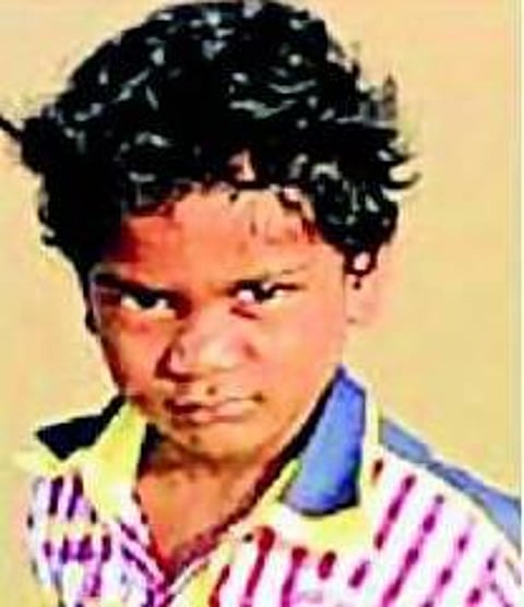 துண்டான கால்களை இணைக்க முடியாத பரிதாபம்: எல்.கே.ஜி குழந்தைக்கு நேர்ந்த துயரம்
