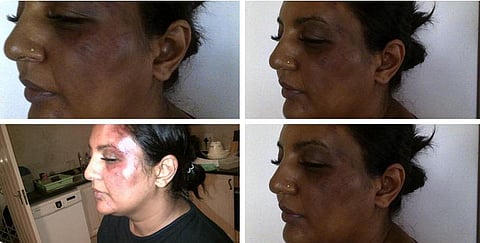 சல்மான் ருஷ்டியை புகழ்ந்த பெண் எழுத்தாளர் மீது கல்வீச்சு