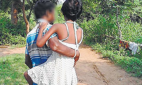 பலாத்காரத்தால் பாதிக்கப்பட்ட மகளை சிகிச்சைக்கு 4 கி.மீ. தூக்கிச் செல்லும் தந்தை