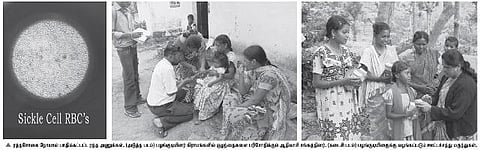 நீலகிரி பழங்குடியின மக்களை அச்சுறுத்தும் ரத்தசோகை நோய்: மனித உயிர்கள் காப்பாற்றப்படுமா?